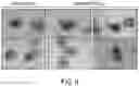 Fig. 10 - RAAV-based compositions and methods for treating amyotrophic lateral sclerosis