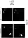 Fig. 22 - RAAV-based compositions and methods for treating amyotrophic lateral sclerosis