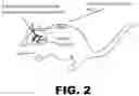 Fig. 03 - Methods for treating Alzheimer's disease