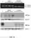 Fig. 13 - Methods for treating Alzheimer's disease
