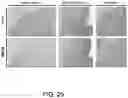Fig. 42 - Methods for treating Alzheimer's disease