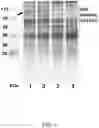 Fig. 05 - Methods for inducible expression of polypeptides