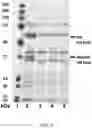 Fig. 07 - Methods for inducible expression of polypeptides
