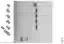 Fig. 20 - Somatic haploid human cell line