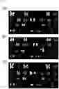 Fig. 34 - Somatic haploid human cell line