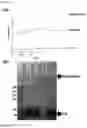 Fig. 07 - GLUCOSE DETECTING COMPLEX AND CONTACT LENS-TYPE SENSOR COMPRISING SAME FOR DETECTING GLUCOSE IN TEARS
