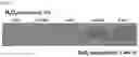 Fig. 13 - GLUCOSE DETECTING COMPLEX AND CONTACT LENS-TYPE SENSOR COMPRISING SAME FOR DETECTING GLUCOSE IN TEARS