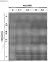 Fig. 15 - GLUCOSE DETECTING COMPLEX AND CONTACT LENS-TYPE SENSOR COMPRISING SAME FOR DETECTING GLUCOSE IN TEARS