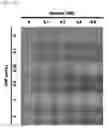 Fig. 17 - GLUCOSE DETECTING COMPLEX AND CONTACT LENS-TYPE SENSOR COMPRISING SAME FOR DETECTING GLUCOSE IN TEARS