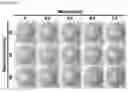 Fig. 35 - GLUCOSE DETECTING COMPLEX AND CONTACT LENS-TYPE SENSOR COMPRISING SAME FOR DETECTING GLUCOSE IN TEARS