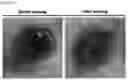 Fig. 46 - GLUCOSE DETECTING COMPLEX AND CONTACT LENS-TYPE SENSOR COMPRISING SAME FOR DETECTING GLUCOSE IN TEARS