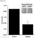 Fig. 47 - GLUCOSE DETECTING COMPLEX AND CONTACT LENS-TYPE SENSOR COMPRISING SAME FOR DETECTING GLUCOSE IN TEARS