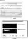 Fig. 06 - Editing profiling of PDE8A pre-mRNA: use as specific biomarker of ADARs activities in human tissues to diagnose and to predict and assess therapeutic efficacy and/or efficiency or potential drug side effects