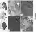 Fig. 09 - COMPOSITIONS, METHODS AND KITS FOR CHARACTERIZING AND SCREENING FOR SMALL CELL OVARIAN CARCINOMA