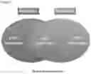 Fig. 03 - COMPOSITIONS AND METHODS FOR THE DETECTION AND TREATMENT OF CERVICAL CANCER AND CERVICAL INTRAEPITHELIAL NEOPLASIA