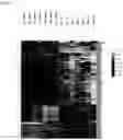 Fig. 04 - COMPOSITIONS AND METHODS FOR THE DETECTION AND TREATMENT OF CERVICAL CANCER AND CERVICAL INTRAEPITHELIAL NEOPLASIA