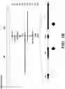 Fig. 03 - DETECTION OF MET AMPLIFICATION TO PREDICT RESPONSIVENESS OF CANCER TO DRUGS