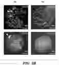 Fig. 07 - DETECTION OF MET AMPLIFICATION TO PREDICT RESPONSIVENESS OF CANCER TO DRUGS