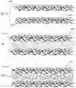 Fig. 07 - Fibrous webs having isotropic structure and apparatus and method for making same