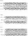 Fig. 10 - Fibrous webs having isotropic structure and apparatus and method for making same