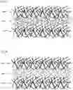 Fig. 11 - Fibrous webs having isotropic structure and apparatus and method for making same
