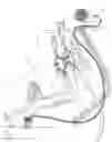 Fig. 02 - Fast fill and shut off system