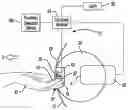 Fig. 01 - Selectively concealed door handle