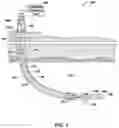 Fig. 02 - Cutting elements configured to reduce impact damage related tools and methods—alternate configurations