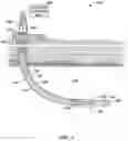 Fig. 02 - Cutting elements configured to reduce impact damage and mitigate polycrystalline, superabrasive material failure earth-boring tools including such cutting elements, and related methods