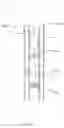 Fig. 02 - Method of establishing a cement plug in an annular region between a first and a second casing