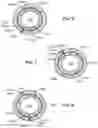 Fig. 07 - MULTILATERAL JUNCTION FITTING FOR INTELLIGENT COMPLETION OF WELL