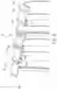 Fig. 05 - CASING ARRANGEMENT FOR AN AXIAL COMPRESSOR OF A GAS TURBINE ENGINE