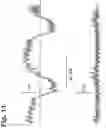 Fig. 12 - Method of operating an internal combustion engine