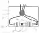 Fig. 01 - Water tank device for an internal combustion engine with water injection