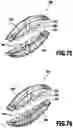 Fig. 41 - Connecting device and method for connecting two parts