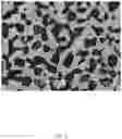 Fig. 06 - PROCESSING OF ALPHA-BETA TITANIUM ALLOYS