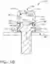 Fig. 11 - Anchoring bolt head for an EME protection cap system
