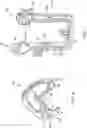 Fig. 06 - Cable block