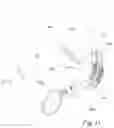 Fig. 11 - Adjustable fastening support for mounting a tubular item on an outer member