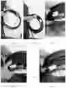 Fig. 04 - Device for reel-less spooling of hoses, flexible pipes and cables