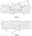 Fig. 04 - Pipe coupling