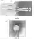Fig. 13 - Membrane hydrophone for high frequency ultrasound and method of manufacture