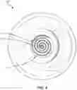 Fig. 09 - Methods and systems for preparing cytological samples