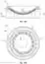 Fig. 17 - Methods and systems for preparing cytological samples