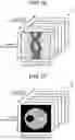 Fig. 13 - Photon counting X-ray CT apparatus