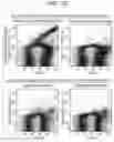 Fig. 10 - Bioparticle measuring method