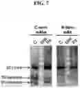 Fig. 10 - DETECTION METHODS EMPLOYING HCV CORE LIPID AND DNA BINDING DOMAIN MONOCLONAL ANTIBODIES