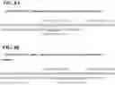Fig. 11 - DETECTION METHODS EMPLOYING HCV CORE LIPID AND DNA BINDING DOMAIN MONOCLONAL ANTIBODIES