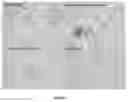 Fig. 05 - METHOD AND KIT FOR DIAGNOSIS AND/OR PROGNOSIS OF NON-HEMATOLOGICAL TUMORS