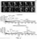 Fig. 06 - DIAGNOSTIC AND THERAPEUTIC METHODS FOR KRAS POSITIVE CANCERS